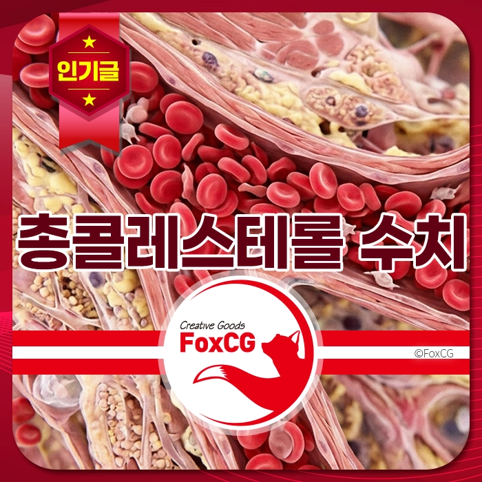 혈관 내부를 따라 적혈구와 콜레스테롤 축적이 뚜렷하게 보이며, 총콜레스테롤 수치 관리와 건강, 혈관 질환 예방에 대한 경각심을 강조함.